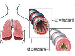 支气管哮喘典型的临床症状是,支气管哮喘的典型临床症状与实地考察数据策略在游戏版的应用,未来解答解析说明_投资版54.80.74