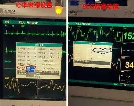 心电监护5个电极位置,心电监护电极位置与深度分析解释定义，安卓款心电监测设备的应用与发展趋势（40.80.83）,科学数据解释定义_纪念版28.98.70